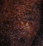 Female HSV-2 (day 1)