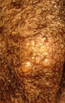 Female HSV-2 (day 2)