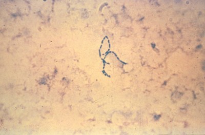 Chancroid virus pictures