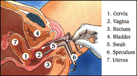 testing for bacterial vaginosis