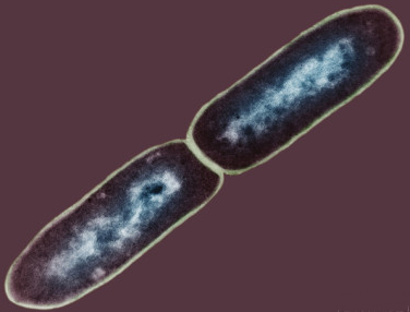 Dividing bacterial cell of Chancroid