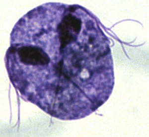 Trichomoniasis Pictures 3 - Herpes & Coldsores Support Network Trichomonas under microscope