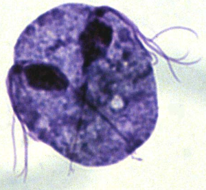 Trichomonas under microscope