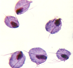 colony of Trichomonas organisms