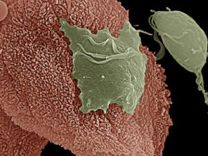 Microscopic view of the Trichomonas organism