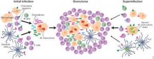 granuloma1