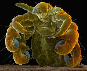 Pubic Lice Pictures 1 - Herpes & Coldsores Support Network Pubic Lice up close