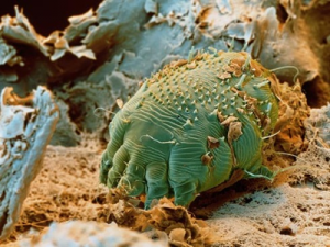 Scabies mite shown close up