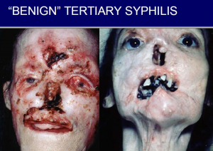 effects of syphilis long term