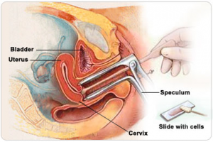 Testing for urinary tract infection