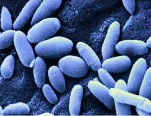 Yeast Infection Pictures 11 - Herpes & Coldsores Support Network Candida Yeast Infection