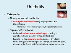 nongonoccal urethritis (NGU) information
